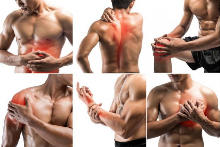 Muskelschmerzen (FAQ)